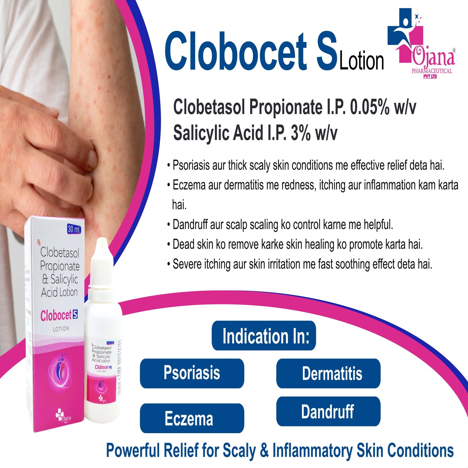Clobocet S lotion