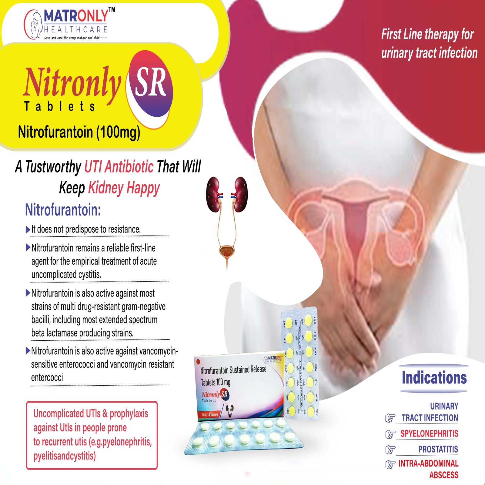 NITRONLY SR